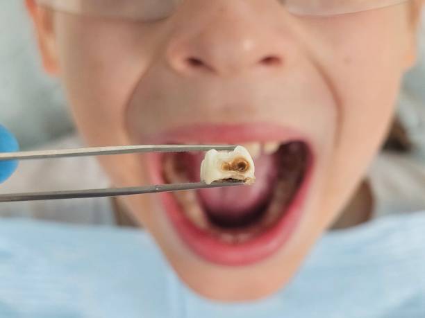 Best Pediatric Emergency Dentist in Oakbrook Terrace, IL
