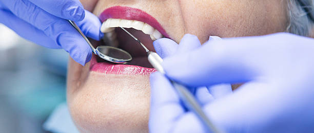 Best Emergency Dental Care for Broken or Chipped Teeth in Oakbrook Terrace, IL